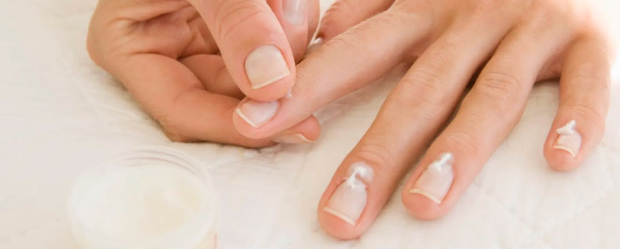 How to treat natural nails after removing gel nails